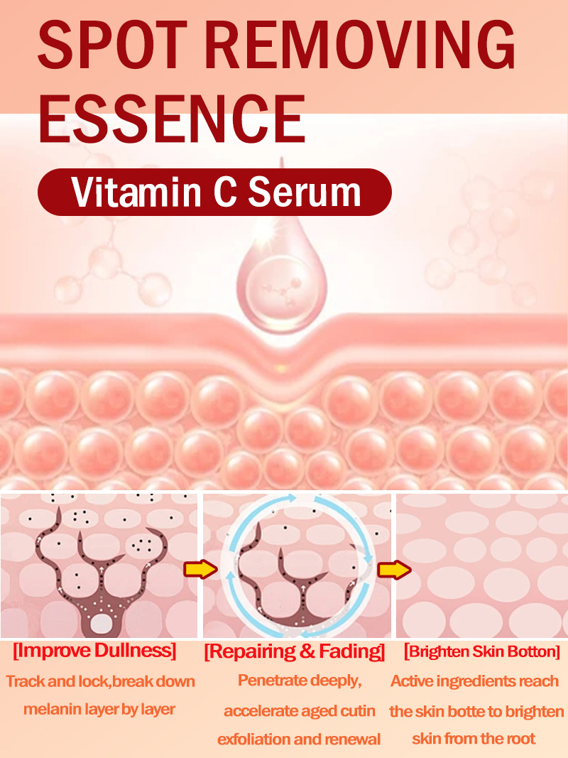 Ilumina las pecas Melasma, las - Luxury Natural Skincare reseña y precio